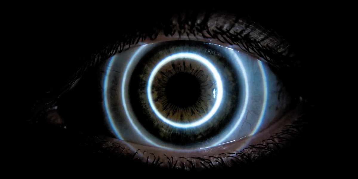 Primer plano de un ojo humano durante una prueba diagnóstica, con anillos concéntricos de luz proyectados sobre la córnea