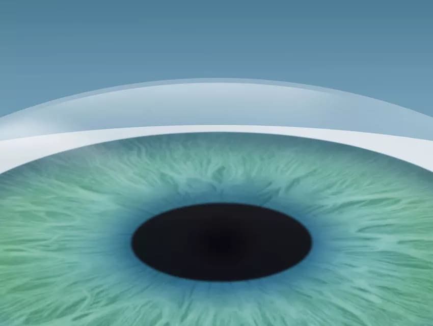 Natural corneal healing after Femto-LASIK procedure